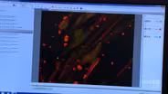 Testing Drugs with a Body On A Chip