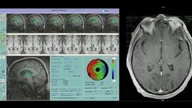 Video thumbnail: Charlottesville Inside-Out Beyond the Flavor/UVa MRI-guided Focused Ultrasound Program