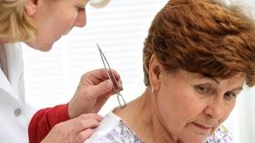 Video thumbnail: Health Link Lyme and Tick Borne Diseases