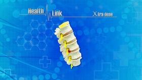 Video thumbnail: Health Link Xtra Dose | Back & Spine Health