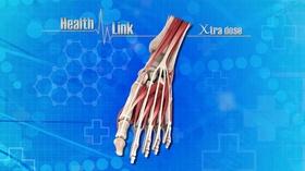 Video thumbnail: Health Link Xtra Dose | Foot Health
