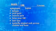 Xtra Dose | Lupus & Scleroderma
