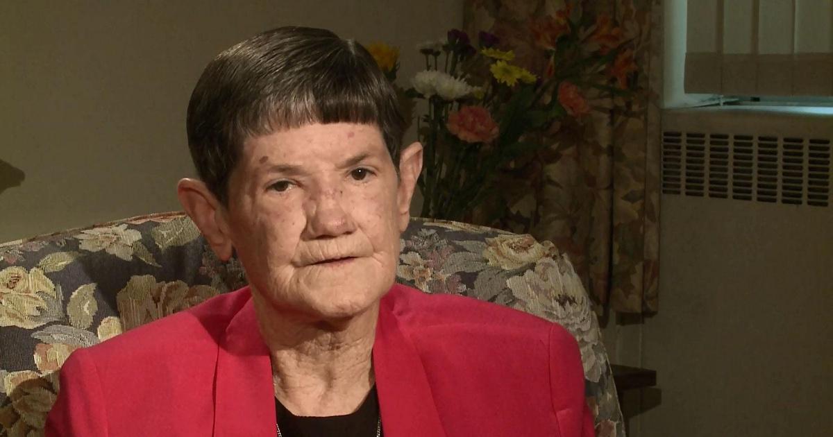 Health Link Sister Mary Rose Noonan on Scleroderma PBS