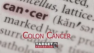 Dr. Bousader-Armstrong "Target-Colon Cancer"