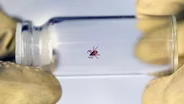 Lyme Disease Not the Only Risk Posed by Ticks