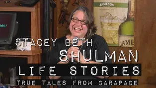Stacey Beth Shulman