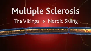 Multiple Sclerosis, the Vikings and Nordic Skiing