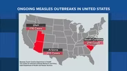 Measles Cases on the Rise as Childhood Vaccine Schedule Changes