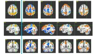 The NFL's "League of Denial"