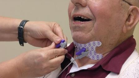 Video thumbnail: SCI TECH CENTRAL Synchronic Dysphagia Solution