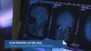 What to Know About Brain Health as You Age