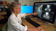 How a new FDA rule could help identify more breast cancer