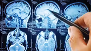 Brain Injury and Concussions
