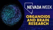 Organoids and Brain Research