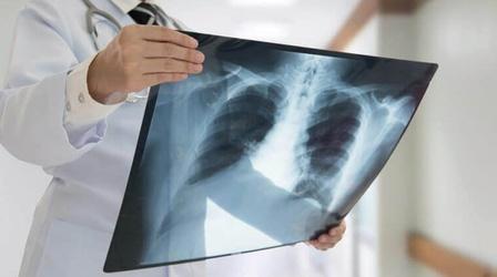 Video thumbnail: Health Matters: Television for Life Lung Cancer