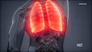 New Report on Lung Cancer in Kentucky