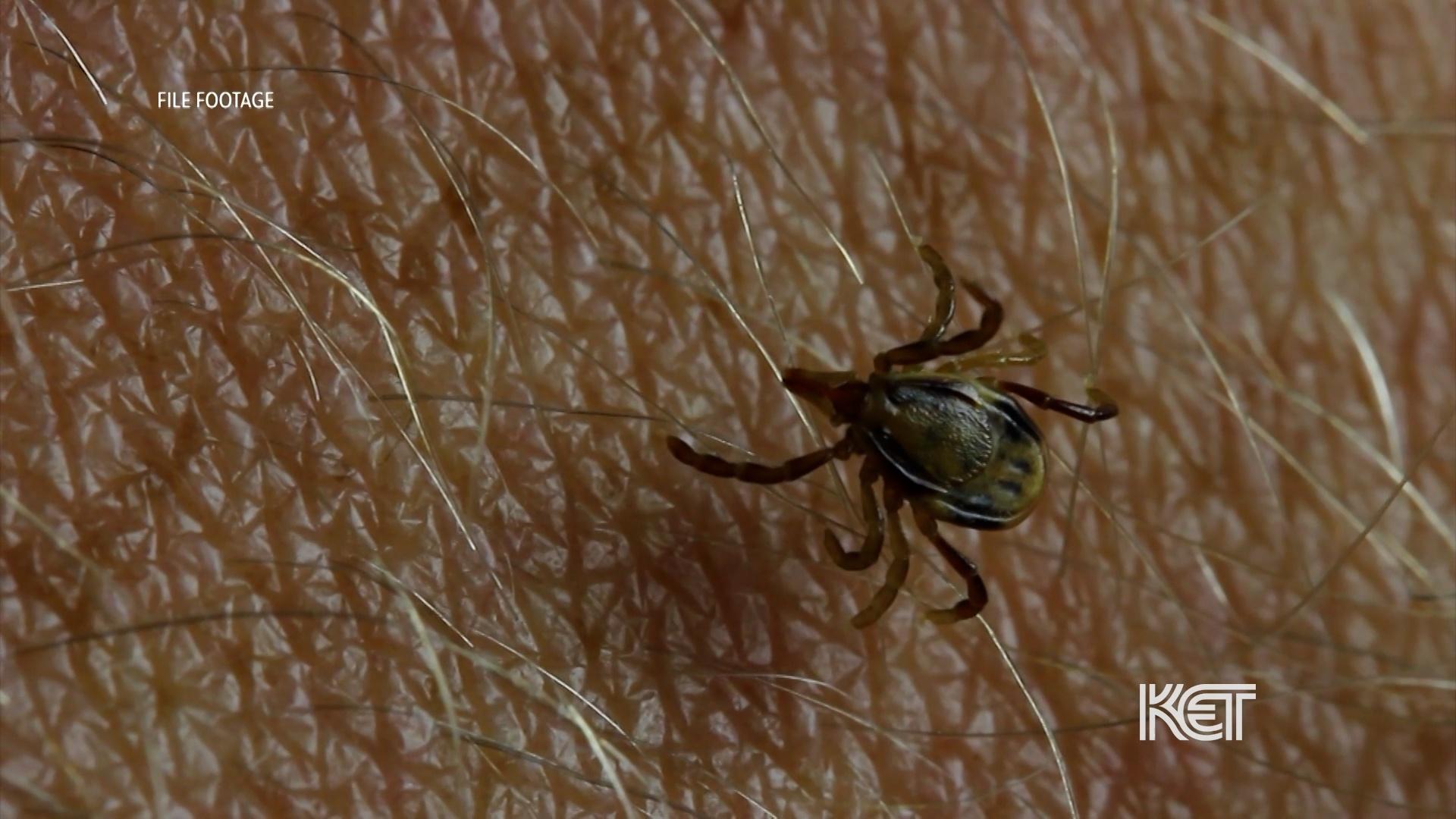 UofL Medical Expert Talks Ticks and What to Do If You Are Bitten By One