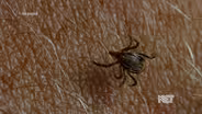UofL Medical Expert Talks Ticks and What to Do If You Are Bitten By One