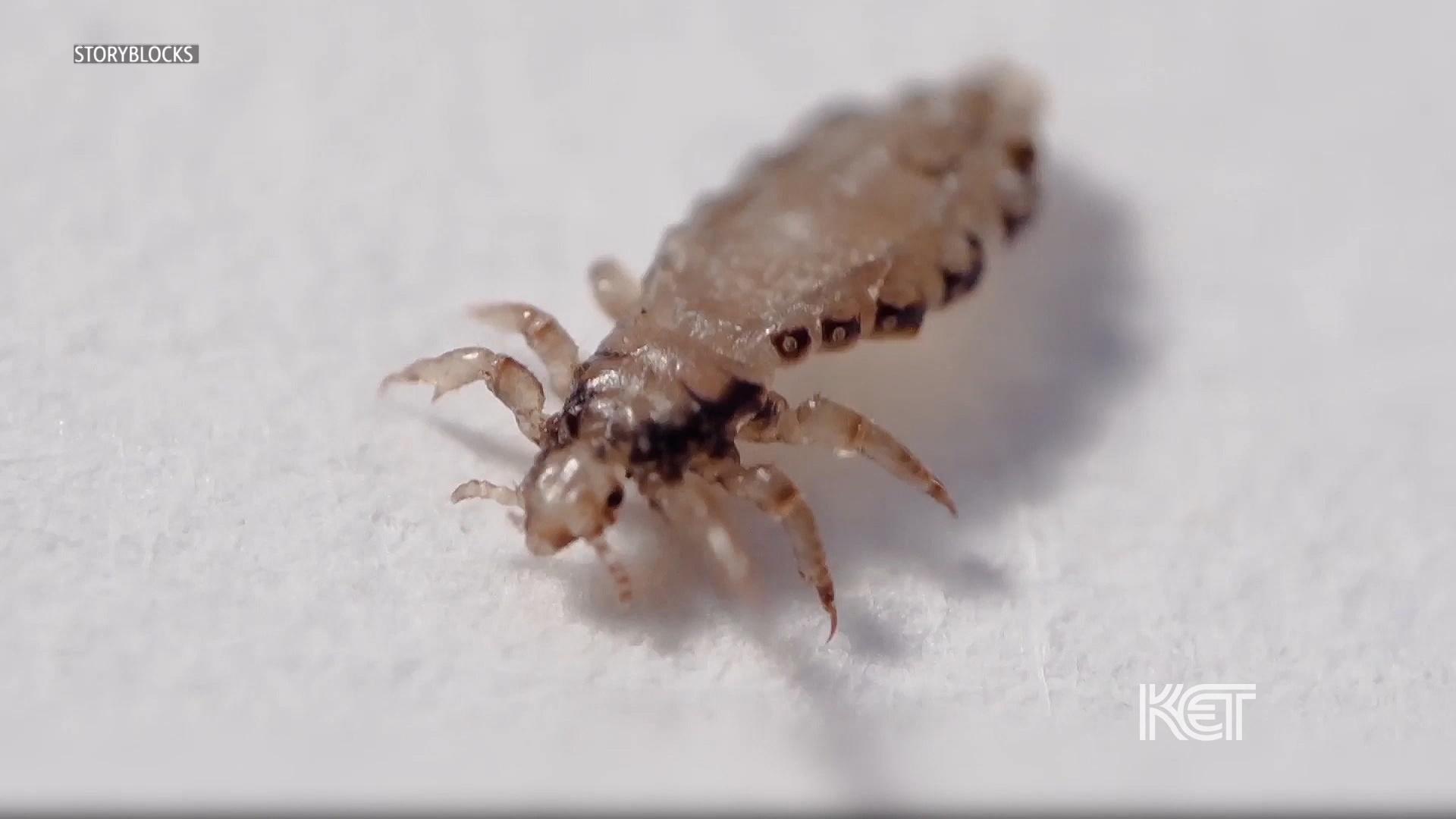 Debunking Head Lice Myths
