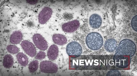 Video thumbnail: NewsNight Monkeypox cases rise in Central Florida