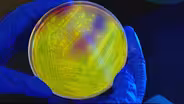 How overuse of antibiotics leads to drug-resistant superbugs