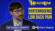 Vertebrogenic Low Back Pain and Nerve Ablation