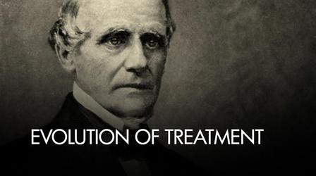 Video thumbnail: WNED PBS History Reimagining a Buffalo Landmark - Evolution of Treatment