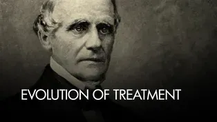 Reimagining a Buffalo Landmark - Evolution of Treatment