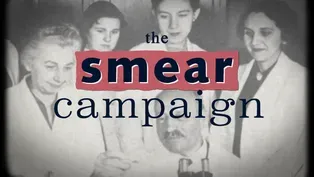 Why the Pap smear almost never saw the light of day | What the History?!