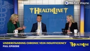Understanding Chronic Vein Insufficiency