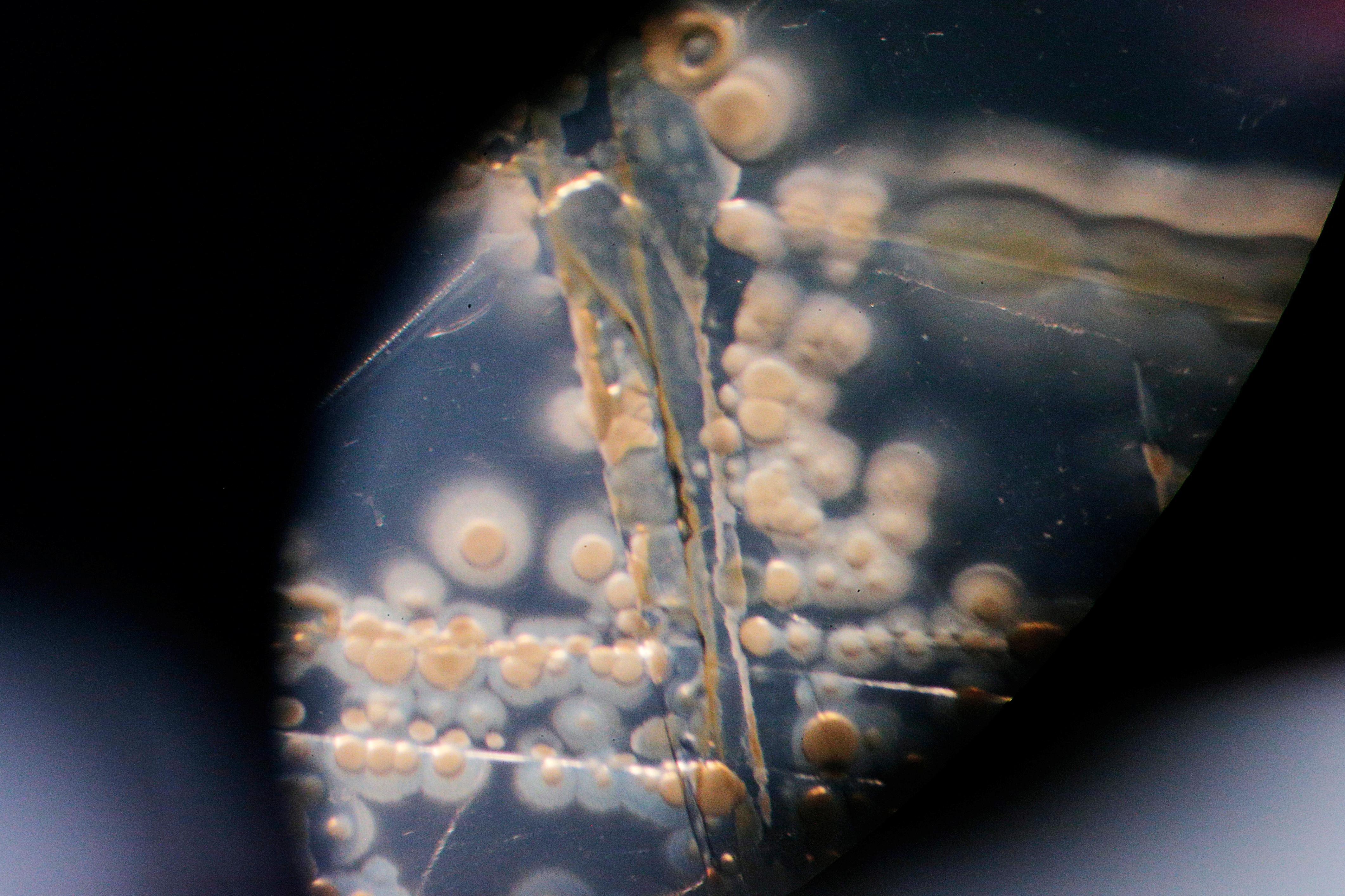 The financial barrier stopping new antibiotics