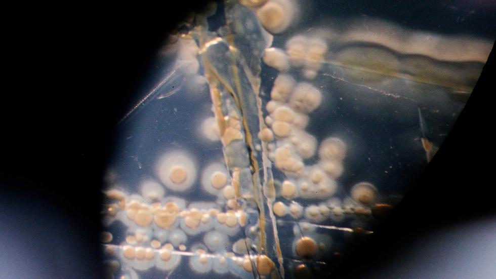 The financial barrier stopping new antibiotics image