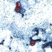 What we know about cyclosporiasis outbreak's link to produce outbreak