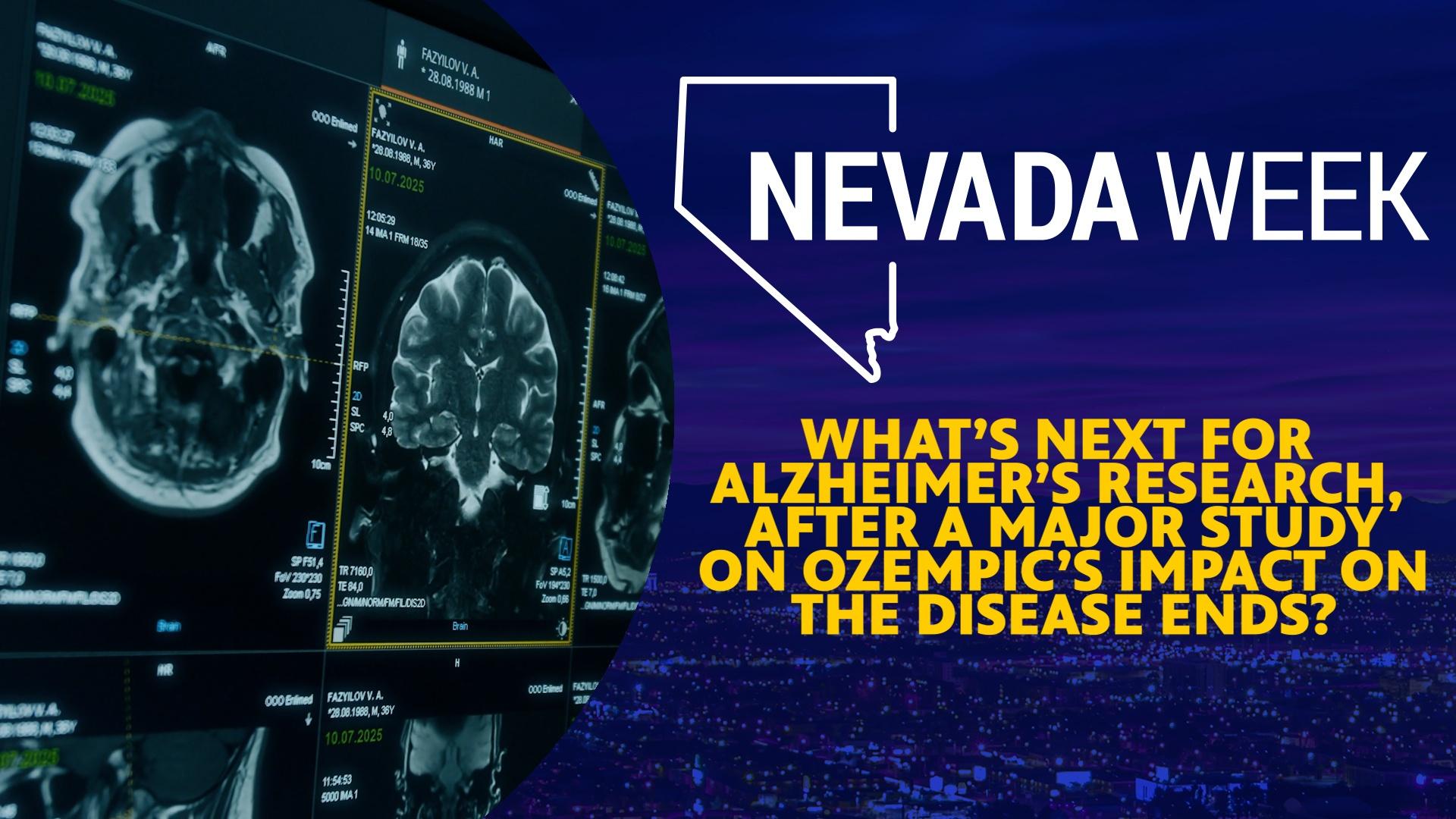 A five year study on Ozempic’s impact in delaying the progression of Alzheimer’s disease has ended.