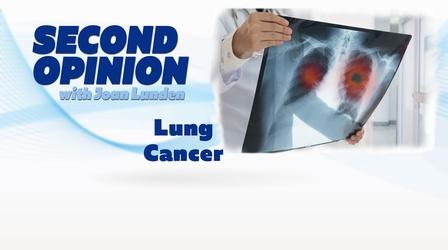 Video thumbnail: Second Opinion with Joan Lunden Lung Cancer