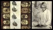 For Dear Life: Art, Medicine, and Disability