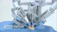 Robotic Surgery