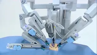 Robotic Surgery