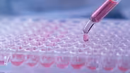 The Promise Of Genetic Sequencing