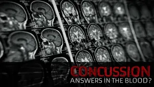 Concussion: Answers in the Blood?