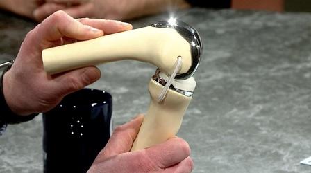 Video thumbnail: Ask the Doctors Orthopedic Medicine