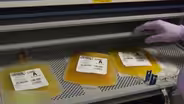 Hospitals using plasma of the recovered as COVID treatment