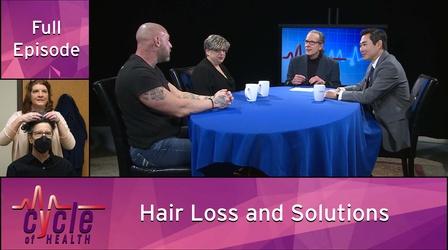 Video thumbnail: Cycle of Health Hair Loss and Solutions