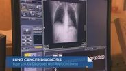 Pope Leo in Recovery After Lung Cancer Diagnosis