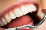 Keeping that Healthy Smile