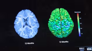 402: Infant Imaging