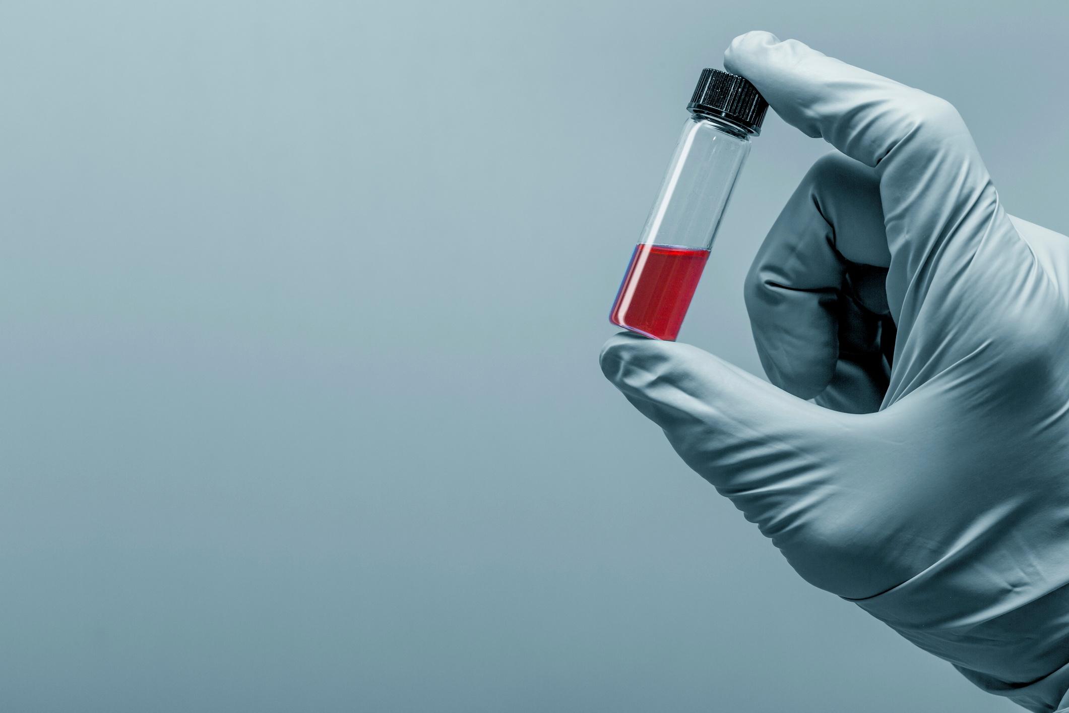 What Happens to Your Blood Test in the Lab?