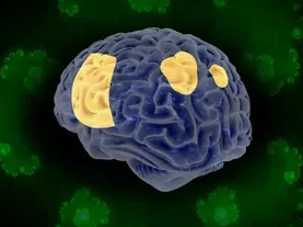 How Psychedelics Change the Brain