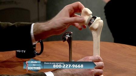 Video thumbnail: Ask the Doctors Orthopedic Medicine