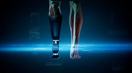 Video thumbnail: NOVA The Evolution of Prosthetic Leg Technology